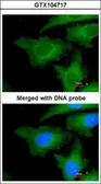 Anti-UBE2L3 antibody used in Immunocytochemistry/ Immunofluorescence (ICC/IF). GTX104717