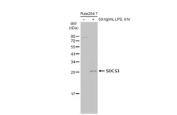 Anti-SOCS3 antibody [C2C3], C-term used in Western Blot (WB). GTX104720