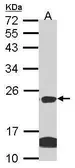 Anti-Claudin 14 antibody [C2C3], C-term used in Western Blot (WB). GTX104751