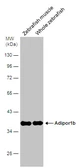 Anti-Adiponectin Receptor 1 antibody [C2C3], C-term used in Western Blot (WB). GTX104770