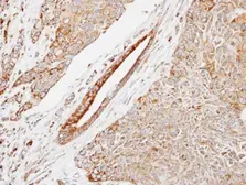 Anti-HSP22 antibody [C2C3], C-term used in IHC (Paraffin sections) (IHC-P). GTX104815