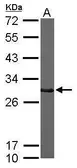 Anti-CTDSP2 antibody used in Western Blot (WB). GTX104889