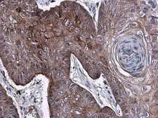 Anti-Elastase 3A antibody used in IHC (Paraffin sections) (IHC-P). GTX104918