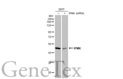 Anti-IPMK antibody [N1C2] used in Western Blot (WB). GTX104954