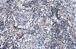 Anti-Fibulin 2 antibody used in IHC (Paraffin sections) (IHC-P). GTX105108