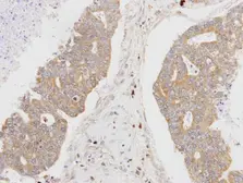 Anti-MSTO1 antibody [N1C1] used in IHC (Paraffin sections) (IHC-P). GTX105110