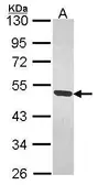 Anti-MAGEB1 antibody used in Western Blot (WB). GTX105112