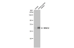 Anti-NR2C2 antibody used in Western Blot (WB). GTX105119