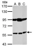 Anti-Bestrophin 1 antibody used in Western Blot (WB). GTX105387