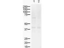 Anti-ZIC2 antibody used in Western Blot (WB). GTX10550
