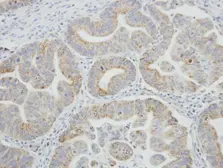 Anti-SRPR antibody [C1C3] used in IHC (Paraffin sections) (IHC-P). GTX105721