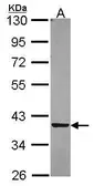 Anti-PIG3 antibody [N2C3] used in Western Blot (WB). GTX105821