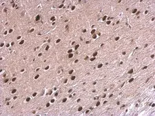 Anti-NPAS1 antibody used in IHC (Paraffin sections) (IHC-P). GTX105876
