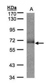 Anti-SUOX antibody [N1C1] used in Western Blot (WB). GTX105902