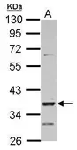 Anti-DMRT1 antibody used in Western Blot (WB). GTX105908