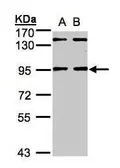 Anti-NRIP antibody used in Western Blot (WB). GTX105954