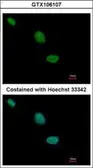 Anti-TLE2 antibody [C2C3], C-term used in Immunocytochemistry/ Immunofluorescence (ICC/IF). GTX106107