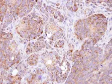 Anti-GSTZ1 antibody [N1C3] used in IHC (Paraffin sections) (IHC-P). GTX106109