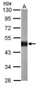 Anti-Carboxypeptidase E antibody [N2C2], Internal used in Western Blot (WB). GTX106177
