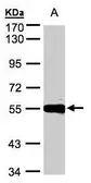 Anti-Carboxypeptidase M antibody [N1C2] used in Western Blot (WB). GTX106203