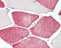 Anti-Tafazzin / TAZ antibody [C2C3], C-term used in IHC (Paraffin sections) (IHC-P). GTX106271