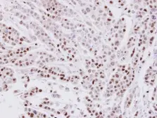 Anti-CIP29 antibody [N1C3] used in IHC (Paraffin sections) (IHC-P). GTX106633