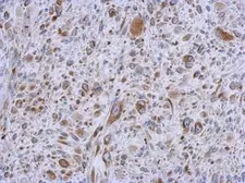 Anti-MMACHC antibody [N1C2] used in IHC (Paraffin sections) (IHC-P). GTX106822