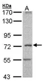 Anti-DNAI2 antibody [C1C3] used in Western Blot (WB). GTX106924