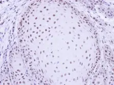 Anti-PRP19 antibody [C1C3] used in IHC (Paraffin sections) (IHC-P). GTX106952