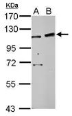 Anti-PHF16 antibody used in Western Blot (WB). GTX107111