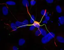 Anti-Doublecortin antibody [N3C3] used in Immunocytochemistry/ Immunofluorescence (ICC/IF). GTX107133