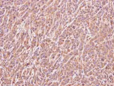 Anti-ART5 antibody [N1C3] used in IHC (Paraffin sections) (IHC-P). GTX107199