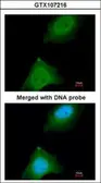 Anti-ASB9 antibody [N1C3] used in Immunocytochemistry/ Immunofluorescence (ICC/IF). GTX107216
