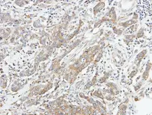 Anti-STK3 antibody used in IHC (Paraffin sections) (IHC-P). GTX107417