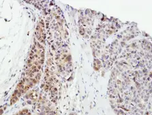Anti-SPHK1 antibody used in IHC (Paraffin sections) (IHC-P). GTX107509