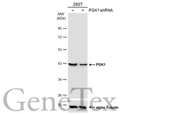 Anti-PGK1 antibody used in Western Blot (WB). GTX107614