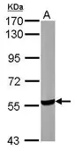 Anti-UGP2 antibody [N1C1-2] used in Western Blot (WB). GTX107616