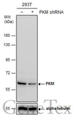 Anti-PKM antibody used in Western Blot (WB). GTX107681