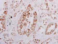 Anti-OSBPL6 antibody [C3], C-term used in IHC (Paraffin sections) (IHC-P). GTX107723