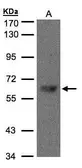Anti-TBL1X antibody [C3], C-term used in Western Blot (WB). GTX107736