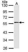 Anti-MST4 antibody [C3], C-term used in Western Blot (WB). GTX107741