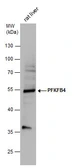 Anti-PFKFB4 antibody used in Western Blot (WB). GTX107755