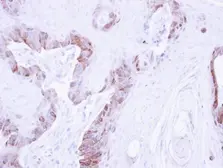 Anti-LIM kinase 2 antibody used in IHC (Paraffin sections) (IHC-P). GTX107784