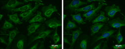 Anti-AK8 antibody [N3C3] used in Immunocytochemistry/ Immunofluorescence (ICC/IF). GTX107840