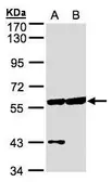 Anti-Copine 3 antibody [N3C3] used in Western Blot (WB). GTX107896