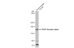 Anti-PDGF Receptor alpha antibody [N2C2], Internal used in Western Blot (WB). GTX107903