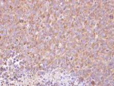 Anti-RIPK5 antibody [C1C3-2] used in IHC (Paraffin sections) (IHC-P). GTX107925