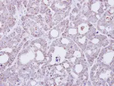 Anti-Transmembrane protein 147 antibody [N1C1] used in IHC (Paraffin sections) (IHC-P). GTX108045