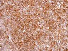 Anti-GHS-R1 antibody [N1], N-term used in IHC (Paraffin sections) (IHC-P). GTX108171