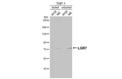 Anti-LGR7 antibody [C3-2], C-term used in Western Blot (WB). GTX108186